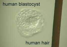Blastocysta obok włosa człowieka
